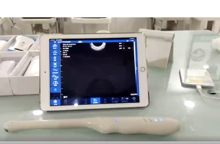 腔内无线探头式手持B超 CProbe 1