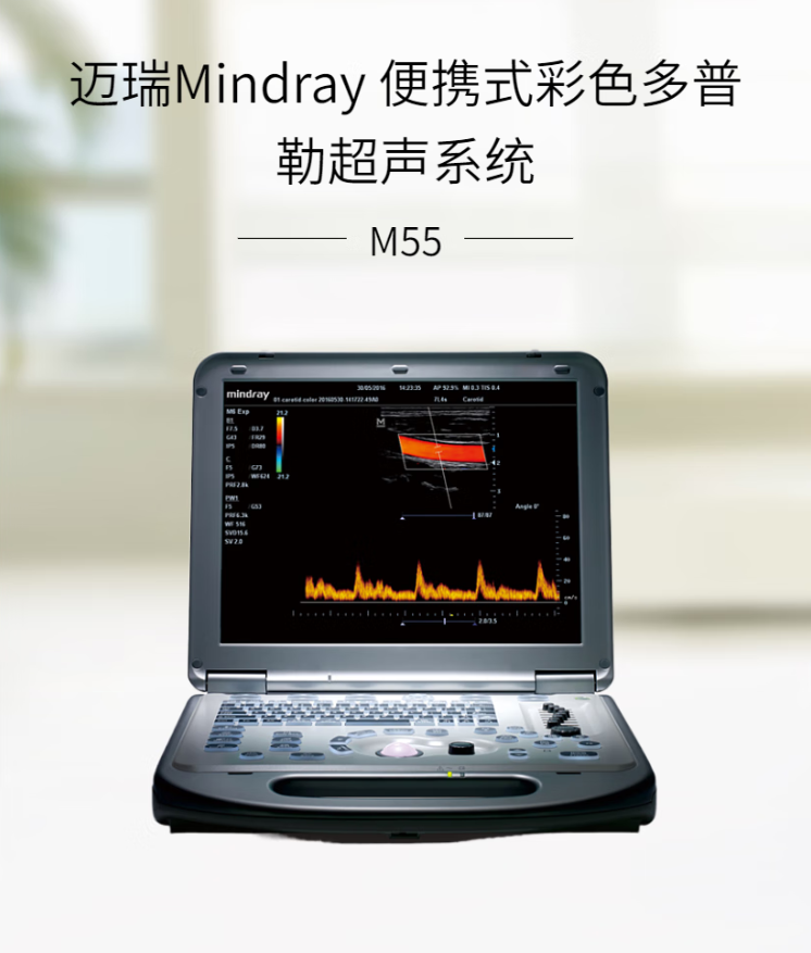 迈瑞 便携彩超M55