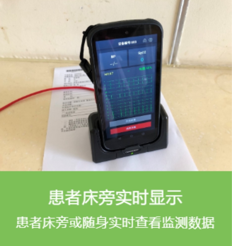 医翼 动态生命体征参数监测仪 (3)